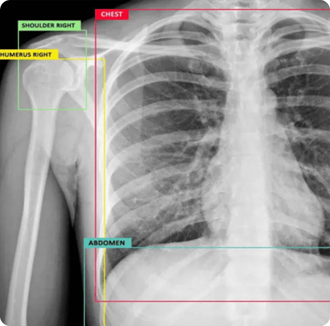 healthcare annotation